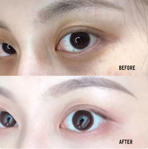 CONTORNO DE OJOS ACIDO HIALURONICO BIOAQUA